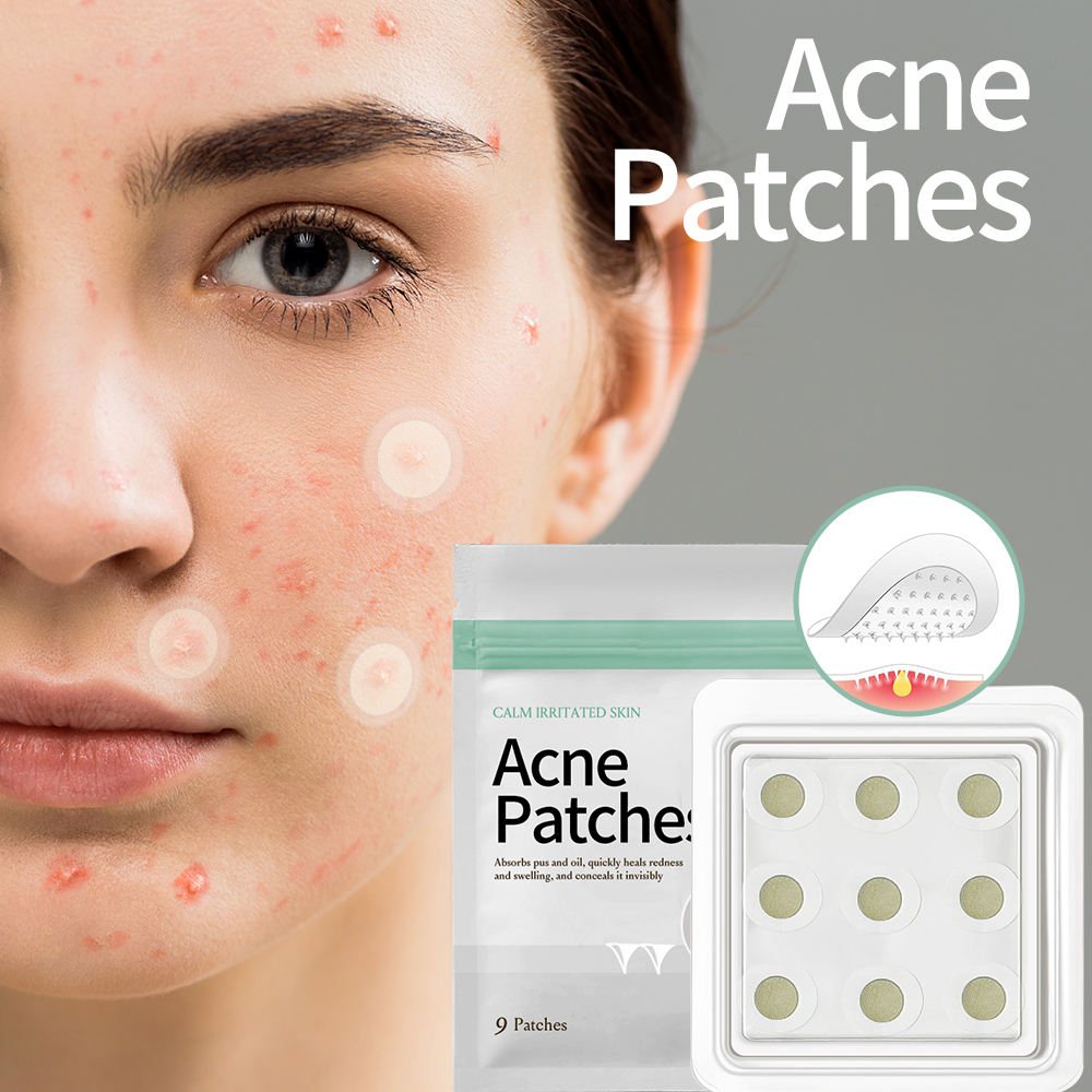 Round Soluble Microneedle Acne Patch, Microdart Pimple Patch for Inflamed Cystic Acne