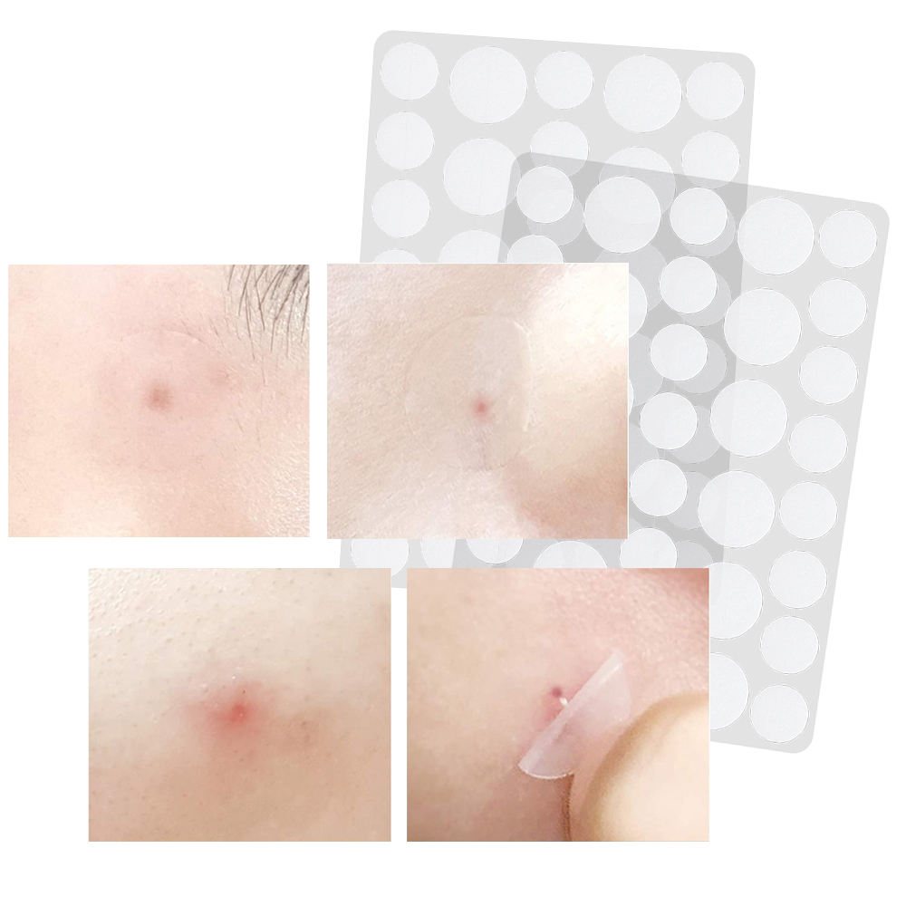 Hydrocolloid Acne Pimple Patch, 2 Sizes Mixed Pack