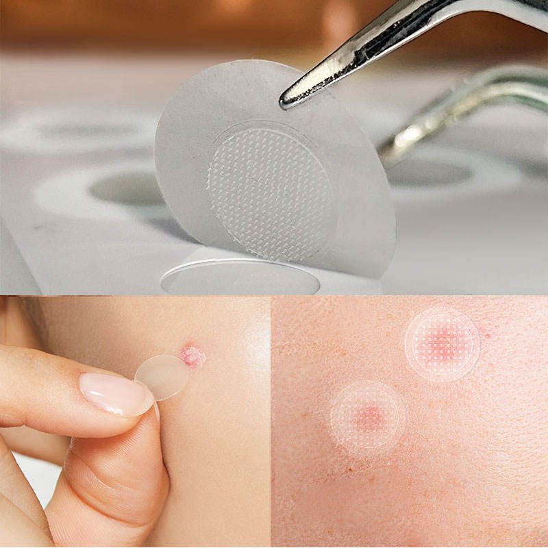Salicylic Acid Soluble Microneedle Acne Patch, 9-Pack